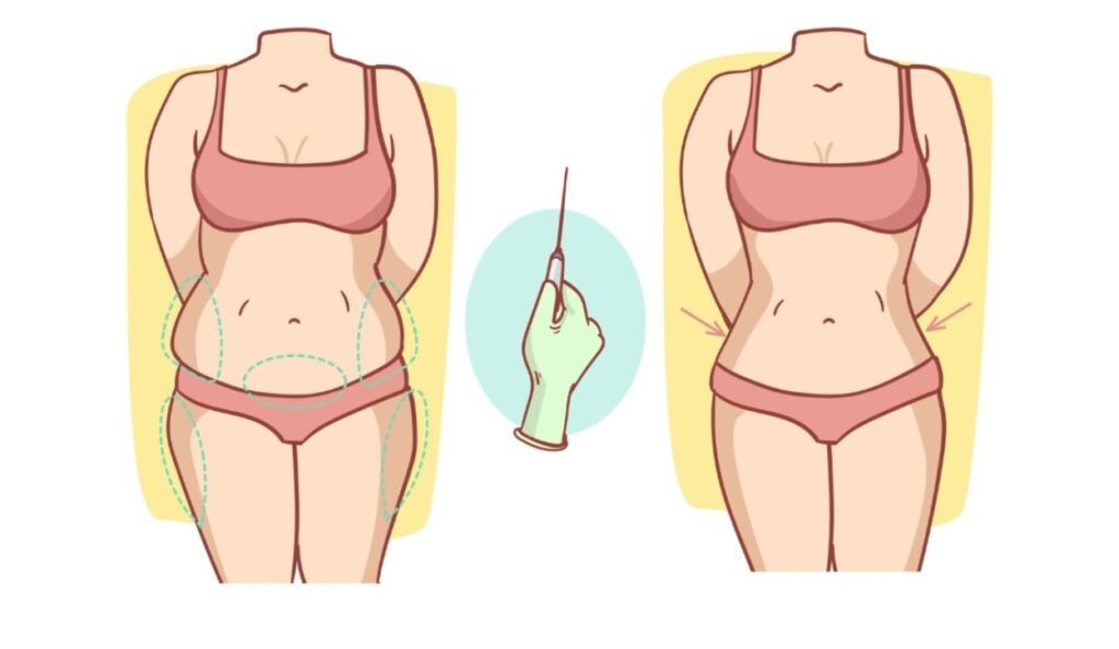 Mommy Makeover surgery explained: procedures, UK safety considerations, recovery planning, costs, risks, and choosing the right provider.