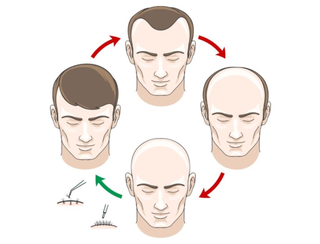 From Bald Patches to Full Hair: A Step-by-Step Guide
